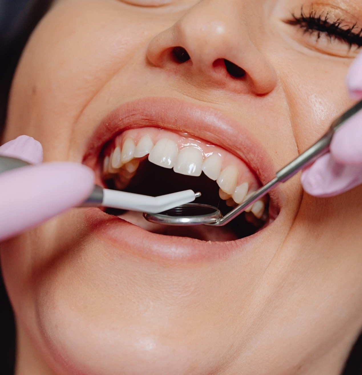 5 señales de que necesitas una higiene bucodental profesional ya