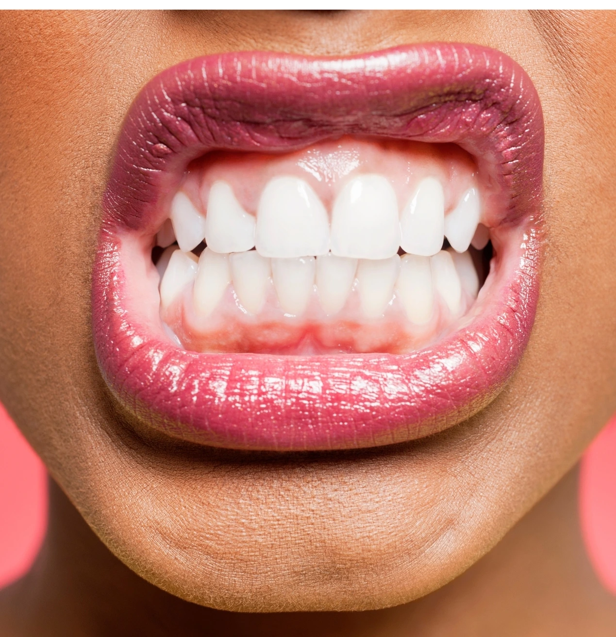 Bruxismo: causas, consecuencias y soluciones odontológicas eficaces