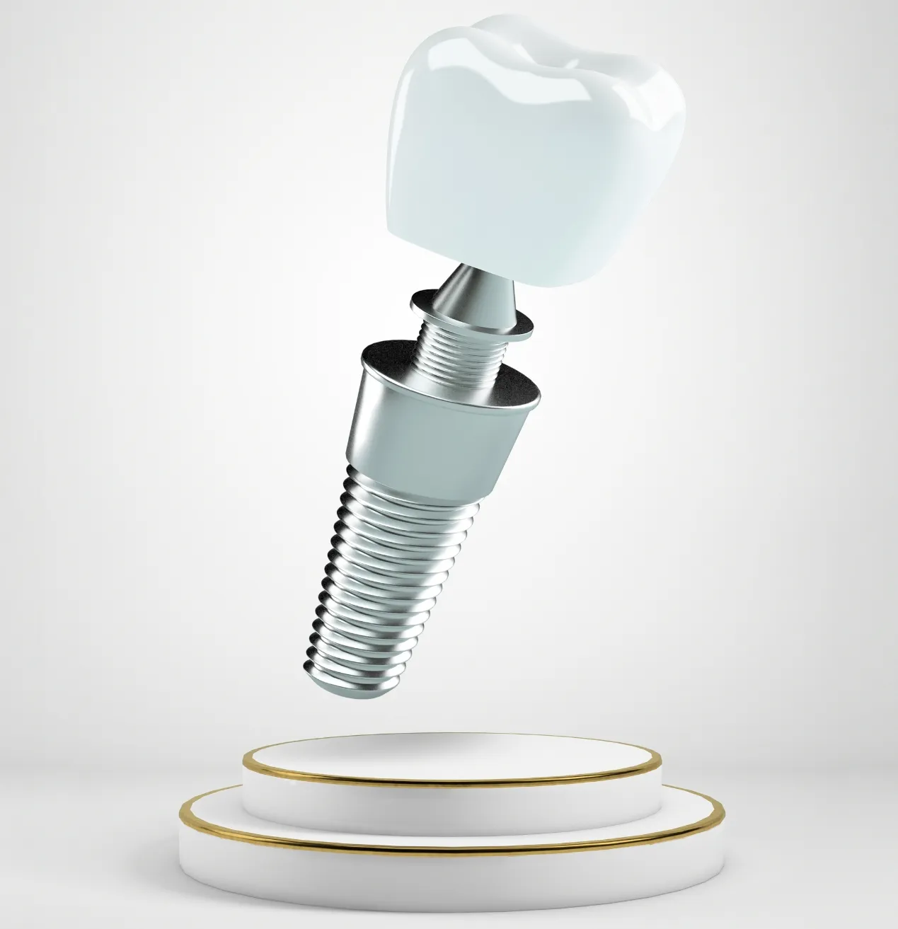 Implantes dentales: ¿cuándo son necesarios y por qué no debes posponerlos?