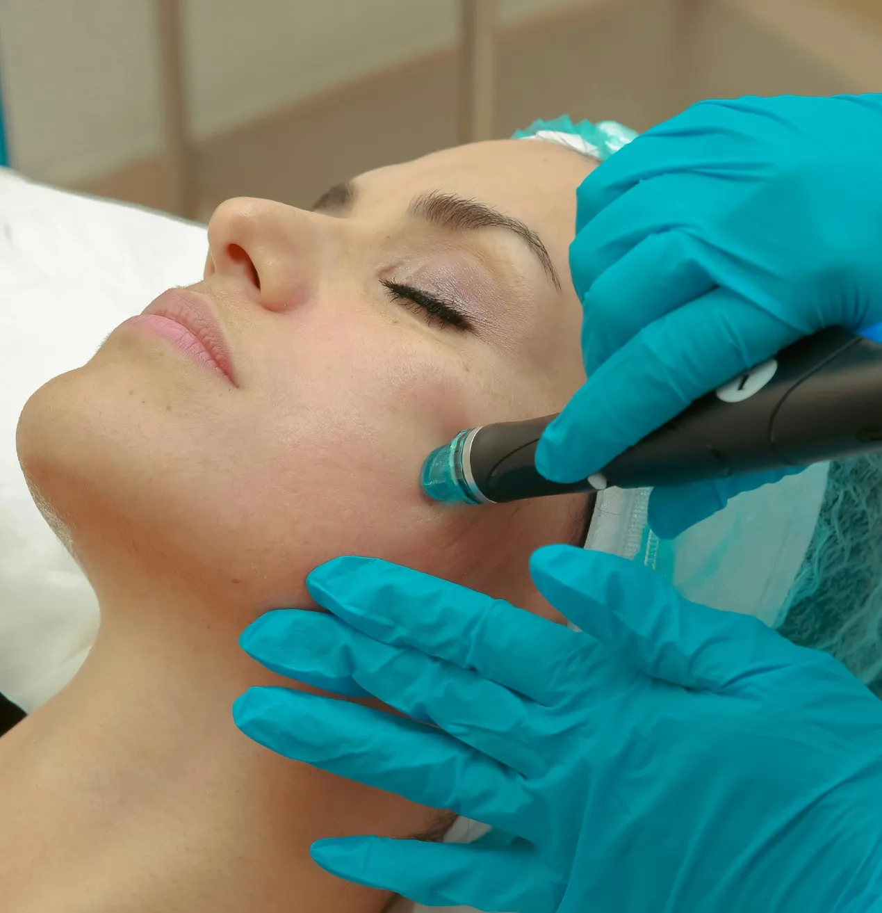 Lifting facial con láser: el tratamiento que está revolucionando el rejuvenecimiento sin cirugía