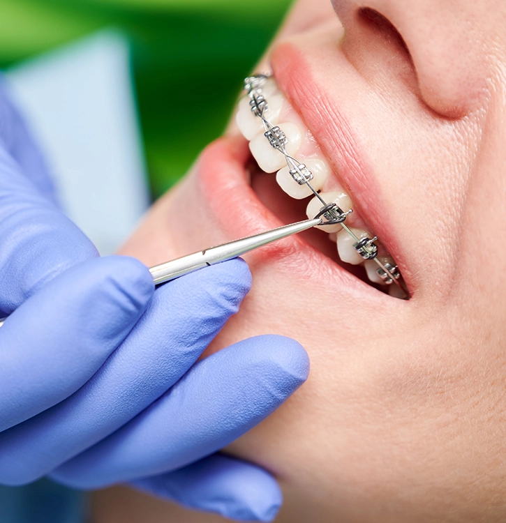 Artículos sobre tratamientos dentales