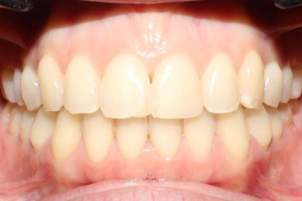 Después: Ortodoncia